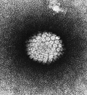 İnsan papilloma virusunun (İPV) elektron mikrofotoşəkli